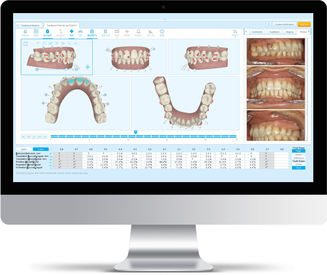 Treatment Planning